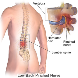Back pain and rheumatic disease