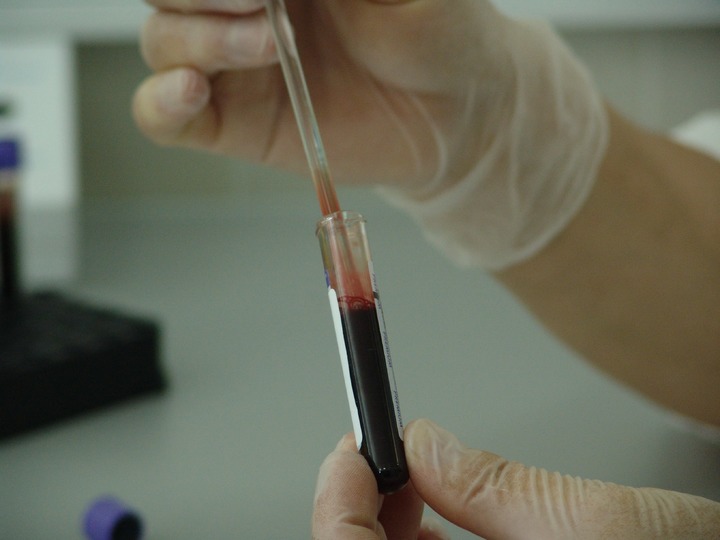 antistoff i blodprøver og biomarkører bindevevssykdommer no
